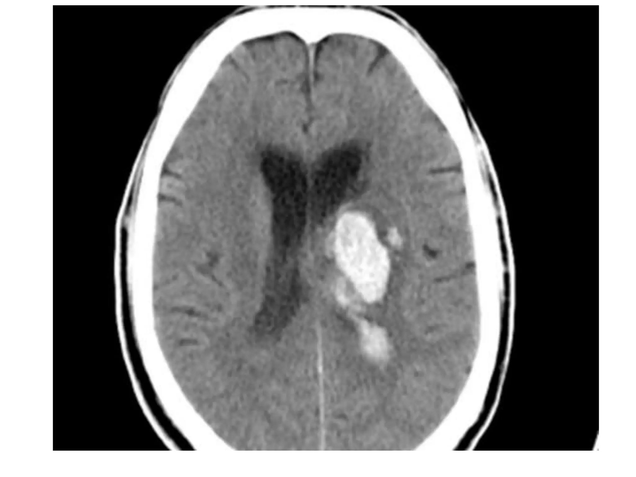 Thalamus and its connection