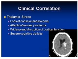 Thalamus and its connection