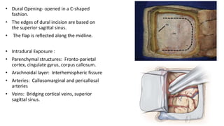 Thalamus and its surgical approaches | PPTX