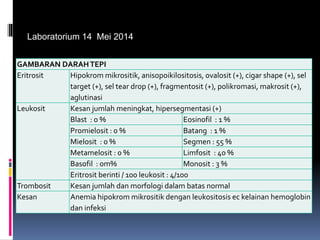 GAMBARAN DARAHTEPI
Eritrosit Hipokrom mikrositik, anisopoikilositosis, ovalosit (+), cigar shape (+), sel
target (+), sel tear drop (+), fragmentosit (+), polikromasi, makrosit (+),
aglutinasi
Leukosit Kesan jumlah meningkat, hipersegmentasi (+)
Blast : 0 % Eosinofil : 1 %
Promielosit : 0 % Batang : 1 %
Mielosit : 0 % Segmen : 55 %
Metamelosit : 0 % Limfosit : 40 %
Basofil : 0m% Monosit : 3 %
Eritrosit berinti / 100 leukosit : 4/100
Trombosit Kesan jumlah dan morfologi dalam batas normal
Kesan Anemia hipokrom mikrositik dengan leukositosis ec kelainan hemoglobin
dan infeksi
Laboratorium 14 Mei 2014
 