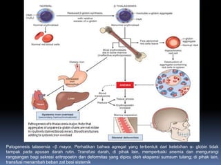 Patogenesis talasemia –β mayor. Perhatikan bahwa agregat yang terbentuk dari kelebihan α- globin tidak
tampak pada apusan darah rutin. Transfusi darah, di pihak lain, memperbaiki anemia dan mengurangi
rangsangan bagi sekresi eritropoetin dan deformitas yang dipicu oleh ekspansi sumsum tulang; di pihak lain,
transfusi menambah beban zat besi sistemik
 