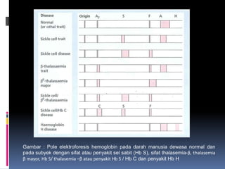 Gambar : Pole elektroforesis hemoglobin pada darah manusia dewasa normal dan
pada subyek dengan sifat atau penyakit sel sabit (Hb S), sifat thalasemia-β, thalasemia
β mayor, Hb S/ thalasemia –β atau penyakit Hb S / Hb C dan penyakit Hb H
 
