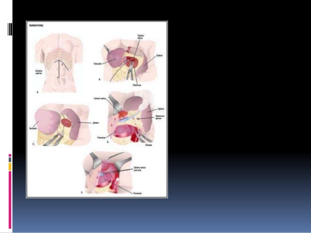 Thalasemia Case Report