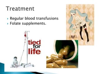  Regular blood transfusions
 Folate supplements.
 