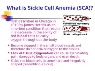 Comprehensive Overview of Thalassaemia and Sickle Cell Anaemia ...