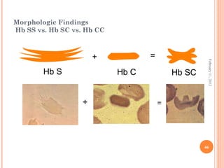 46
February11,2012
Morphologic Findings
Hb SS vs. Hb SC vs. Hb CC
=+
Hb S Hb C Hb SC
+ =
 