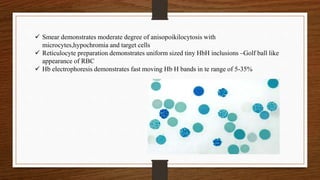  Smear demonstrates moderate degree of anisopoikilocytosis with
microcytes,hypochromia and target cells
 Reticulocyte preparation demonstrates uniform sized tiny HbH inclusions –Golf ball like
appearance of RBC
 Hb electrophoresis demonstrates fast moving Hb H bands in te range of 5-35%
 