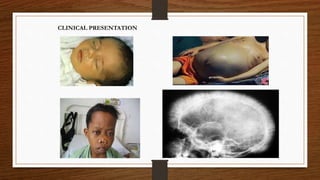 CLINICAL PRESENTATION
 