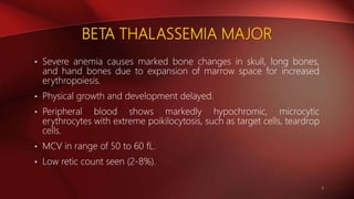 BETA THALASSEMIA MAJOR
• Severe anemia causes marked bone changes in skull, long bones,
and hand bones due to expansion of marrow space for increased
erythropoiesis.
• Physical growth and development delayed.
• Peripheral blood shows markedly hypochromic, microcytic
erythrocytes with extreme poikilocytosis, such as target cells, teardrop
cells.
• MCV in range of 50 to 60 fL.
• Low retic count seen (2-8%).
8
 