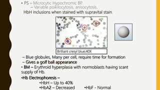 • PS – Microcytic Hypochromic BP.
– Variable poikilocytosis, anisocytosis.
HbH inclusions when stained with supravital stain.
Brilliant cresyl blue;40X
– Blue globules, Many per cell, require time for formation
– Gives a golf ball appearance
• BM – Erythroid hyperplasia with normoblasts having scant
supply of Hb.
•Hb Electrophoresis –
•HbH – Up to 40%
•HbA2 – Decreased •HbF - Normal
 