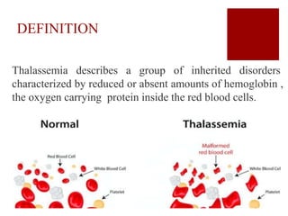 DEFINITION
Thalassemia describes a group of inherited disorders
characterized by reduced or absent amounts of hemoglobin ,
the oxygen carrying protein inside the red blood cells.
 