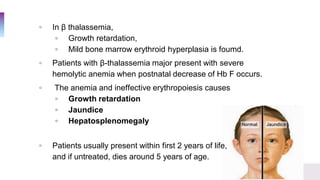 ▫ In β thalassemia,
▫ Growth retardation,
▫ Mild bone marrow erythroid hyperplasia is foumd.
▫ Patients with β-thalassemia major present with severe
hemolytic anemia when postnatal decrease of Hb F occurs.
▫ The anemia and ineffective erythropoiesis causes
▫ Growth retardation
▫ Jaundice
▫ Hepatosplenomegaly
▫ Patients usually present within first 2 years of life,
and if untreated, dies around 5 years of age.
 