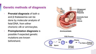 Genetic methods of diagnosis
▫ Prenatal diagnosis of both α
and β thalassemia can be
done by molecular analysis of
fetal DNA, from either
chorionic villi or amniocytes.
▫ Preimplantation diagnosis is
possible if expected genetic
mutations are known
beforehand.
 