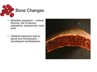 • Medullary expansion – cortical
thinning, risk of fracture,
osteopenia, osteoporosis, back
ache.
• Vertebral expansion lead to
spinal cord compression –
neurological manifestations.
Bone Changes
 