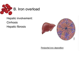 Hepatic involvement:
Cirrhosis
Hepatic fibrosis
B. Iron overload
 