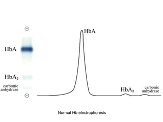 Normal Hb electrophoresis
 