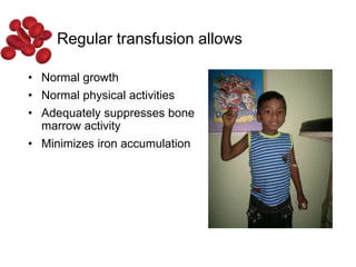 • Normal growth
• Normal physical activities
• Adequately suppresses bone
marrow activity
• Minimizes iron accumulation
Regular transfusion allows
 