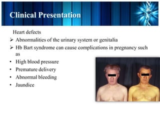Clinical Presentation
Heart defects
 Abnormalities of the urinary system or genitalia
 Hb Bart syndrome can cause complications in pregnancy such
as
• High blood pressure
• Premature delivery
• Abnormal bleeding
• Jaundice
 