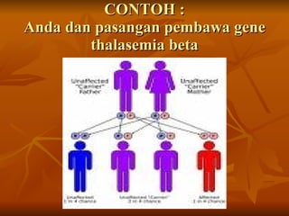 CONTOH : Anda dan pasangan pembawa gene thalasemia beta 