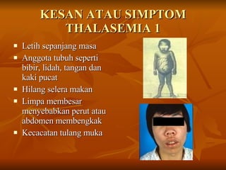KESAN ATAU SIMPTOM THALASEMIA 1 Letih sepanjang masa Anggota tubuh seperti bibir, lidah, tangan dan kaki pucat Hilang selera makan Limpa membesar menyebabkan perut atau abdomen membengkak Kecacatan tulang muka  