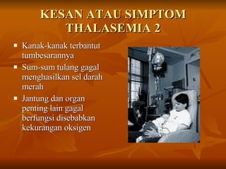 KESAN ATAU SIMPTOM THALASEMIA 2 Kanak-kanak terbantut tumbesarannya Sum-sum tulang gagal menghasilkan sel darah merah Jantung dan organ penting lain gagal berfungsi disebabkan kekurangan oksigen 