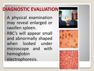 DIAGNOSTIC EVALUATION
 A physical examination
may reveal enlarged or
swollen spleen.
 RBC’s will appear small
and abnormally shaped
when looked under
microscope and with
hemoglobin
 electrophoresis.
 