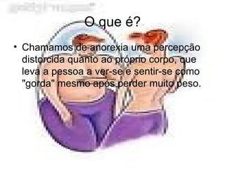 O que é? Chamamos de anorexia uma percepção distorcida quanto ao próprio corpo, que leva a pessoa a ver-se e sentir-se como "gorda" mesmo após perder muito peso.  
