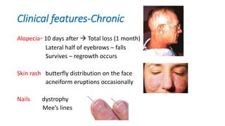 Clinical features-Chronic
Alopecia- 10 days after  Total loss (1 month)
Lateral half of eyebrows – falls
Survives – regrowth occurs
Skin rash butterfly distribution on the face
acneiform eruptions occasionally
Nails dystrophy
Mee’s lines
 