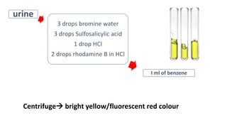 urine
3 drops bromine water
3 drops Sulfosalicylic acid
1 drop HCl
2 drops rhodamine B in HCl
I ml of benzene
Centrifuge bright yellow/fluorescent red colour
 