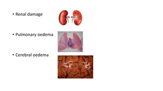 • Renal damage
• Pulmonary oedema
• Cerebral oedema
 