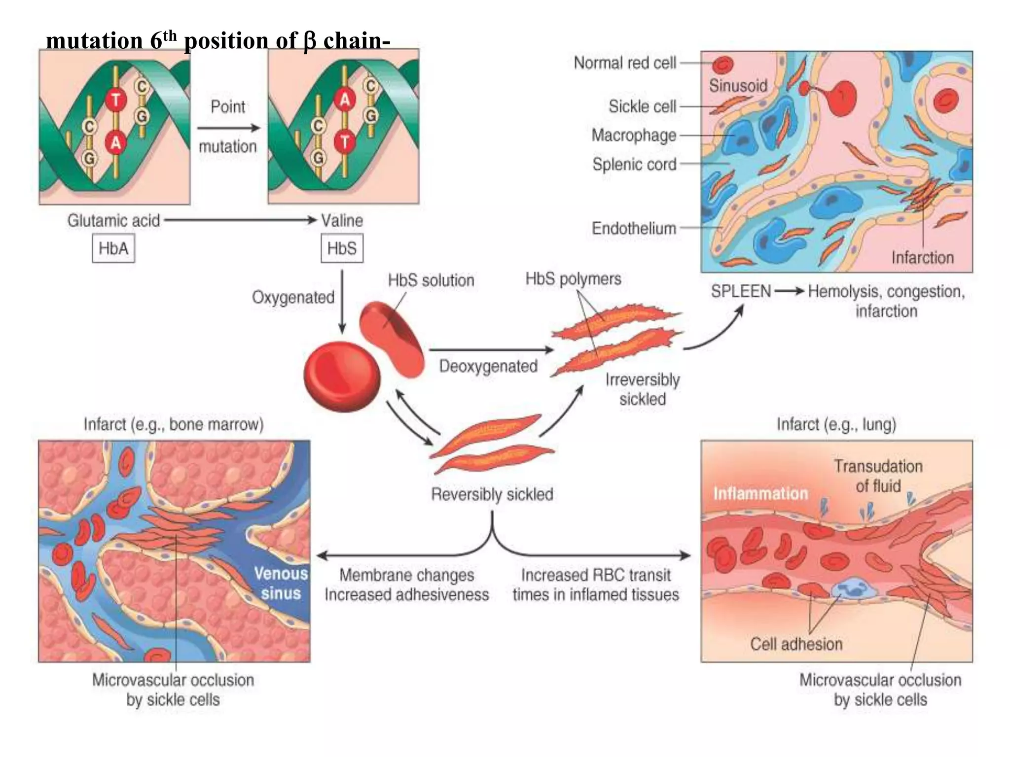 thalassemia and sickle cell disease | PPT