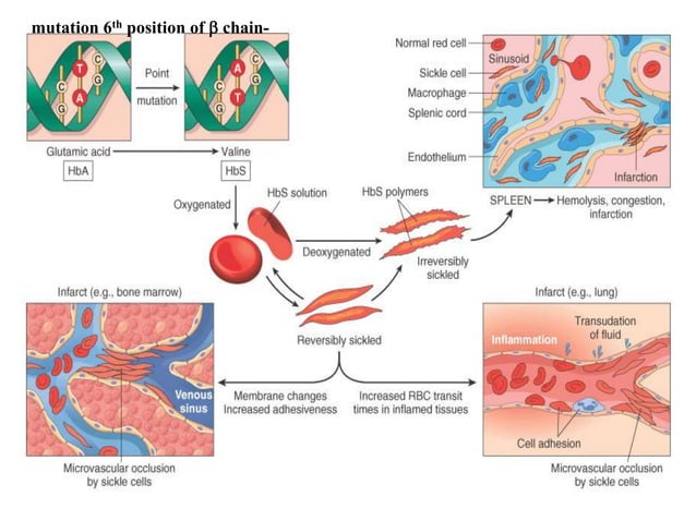 thalassemia and sickle cell disease | PPT