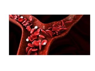 thalassemia and sickle cell disease | PPT