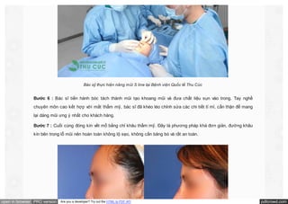 Bác sỹ thực hiện nâng mũi S line tại Bệnh viện Quốc tế Thu Cúc

Bước 6 : Bác sĩ tiến hành bóc tách thành mũi tạo khoang mũi và đưa chất liệu sụn vào trong. Tay nghề
chuyên môn cao kết hợp với mắt thẩm mỹ, bác sĩ đã khéo léo chỉnh sửa các chi tiết tỉ mỉ, cẩn thận để mang
lại dáng mũi ưng ý nhất cho khách hàng.
Bước 7 : Cuối cùng đóng kín vết mổ bằng chỉ khâu thẩm mỹ. Đây là phương pháp khá đơn giản, đường khâu
kín bên trong lỗ mũi nên hoàn toàn không lộ sẹo, không cần băng bó và rất an toàn.

open in browser PRO version

Are you a developer? Try out the HTML to PDF API

pdfcrowd.com

 