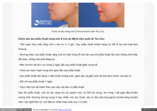 Trước và sau nâng mũi S line tại b ệnh viện Thu Cúc

Chăm sóc sau phẫu thuật nâng mũi S line tại Bệnh viện quốc tế Thu Cúc:
- Thời gian thực hiện nâng mũi s line từ 2- 3 giờ. Sau phẫu thuật khách hàng có thể đi lại sinh hoạt bình
thường
- Đường khâu của phẫu thuật nâng mũi kín bên trong lỗ mũi nên sau khi phẫu thuật hầu như không nhìn thấy
vết khâu, không cần phải băng lại.
- Nên chườm đá tích cực trong 2 ngày đầu sau phẫu thuật giảm sưng nề.
- Tránh va chạm mạnh trong thời gian đầu sau phẫu thuật.
- Sau phẫu thuật nên dùng 1 tuần thuốc kháng sinh, giảm đau và giảm phù nề theo đơn thuốc của bác sĩ.
- Cắt chỉ sau phẫu thuật 7 ngày.
- Thực hiện lịch tái khám theo yêu cầu của bác sĩ phẫu thuật.
Sau khi phẫu thuật, mũi và các vùng khu trú quanh mũi, có thể hơi sưng, tím trong 1 vài ngày đầu là hiện
tượng bình thường nhưng sưng ít hay nhiều còn tùy thuộc vào cơ địa của từng người và khả năng chuyên
môn, tay nghề bác sỹ, mũi đẹp tự nhiên hoàn toàn sau 1-2 tuần.
open in browser PRO version

Are you a developer? Try out the HTML to PDF API

pdfcrowd.com

 