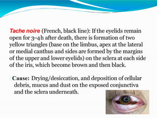 Tache noire (French, black line): If the eyelids remain
open for 3–4h after death, there is formation of two
yellow triangles (base on the limbus, apex at the lateral
or medial canthus and sides are formed by the margins
of the upper and lower eyelids) on the sclera at each side
of the iris, which become brown and then black.
Cause: Drying/desiccation, and deposition of cellular
debris, mucus and dust on the exposed conjunctiva
and the sclera underneath.
 