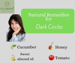 Natural Remedies for   Dark Circles