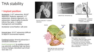 THA stability
• Implant position:
Acetabular: 5-25⁰ anteversion, 30-50⁰
abduction. Posterior approach →↑
anteversion. Anterior approach →↓
anteversion. Hypertrophy of anterior
inferior iliac spine → implant
impingement and instability.
Acetabular screw fixation: safe zone
Femoral stem: 10-15⁰ anteversion (difficult
to adjust in uncemented implant).
Combined version: femoral anteversion +
acetabular anteversion = 37⁰
Avoid impingement: by avoiding: pround
cup anteriorly, medialized high cup (bone-
to-bone impinge), lateralized cup & head-
neck ratio <2:1
↑↑retroversion → posterior
dislocation. ↑↑ anteversion
→ anterior dislocation.
Theta angle of cup inclination.
↑↑abduction (high theta angle, vertical
cup) → posterior superior dislocation ,
eccentric poly wear and later instability.
↑↑adduction (low theta angle, horizontal
cup) → impingement in flexion and
inferior dislocation.
Lateral X-ray: retroverted cup
Excessive abduction → posterior
dislocation
With high hip center, structures in
‘danger zone’ come close to safe
zone
 