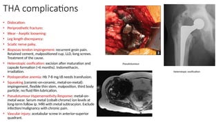 THA complications
• Dislocation:
• Periprosthetic fracture:
• Wear - Aseptic loosening:
• Leg length discrepancy:
• Sciatic nerve palsy.
• Iliopsoas tendon impingement: recurrent groin pain.
Retained cement, malpositioned cup, LLD, long screws.
Treatment of the cause.
• Heterotopic ossification: excision after maturation and
capsule formation (>6 months). Indomethacin,
irradiation.
• Postoperative anemia: Hb 7-8 mg/dl needs transfusion.
• Squeaking (ceramic-on-ceramic, metal-on-metal):
impingement, flexible thin stem, malposition, third body
particle, no fluid film lubrication.
• Pseudotumour Hypersensetivity Response: metal-on-
metal wear. Serum metal (cobalt-chrome) ion levels at
long-term follow ip. MRI with metal subtracyion. Exclude
infection/malignancy with chronic pain.
• Vascular injury: acetabular screw in anterior-superior
quadrant.
Pseudotumour
Heterotopic ossification
 