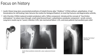 Focus on history
• Austin Moore long-stem uncemented prosthesis of Cobalt-Chrome alloy “Vitallium” (1950s) without polyethylene. It had
fenestrations for self-locking ( later became the motive for biological fixation), to treat hip fractures and degenerative arthritis.
• John Charnley (1960s) replaced eroded acetabulum with a Teflon component. Introduced the concept of “low friction
arthroplasty” to reduce wear through: small metal femoral head + polyethylene acetabular component + acrylic cement.
Long-term results (up to 7 years): Infection 3.8%, late mechanical failure 1.3%, and most patients had excellent pain relief.
Austin Moore prosthesis revised with a calcar replacement femoral
stem
Charnley “low friction”
arthroplasty
 