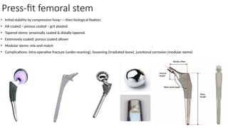 Press-fit femoral stem
• Initial stability by compression hoop --- then biological fixation.
• HA coated – porous coated – grit plasted.
• Tapered stems: proximally coated & distally tapered.
• Extensively coated: porous coated allover
• Modular stems: mix-and-match
• Complications: intra-operative fracture (under-reaming), loosening (irradiated bone), junctional corrosion (modular stems)
 