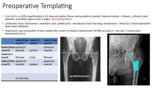 Preoperative Templating
• Pelvis AP X-ray (20% magnification) in 15◦ internal rotation (femur neck parallel to cassette). External rotation → falsely ↓ offset & canal
diameter, and falsely appear neck in valgus. Hip Frog leg lateral.
• Landmarks: Femur (trochanters, medullary canal, saddle joint) – Acetabulum (roof, tear drop, retroversion) – Pelvis (LLI: ischial tuberosities
level, pelvic obliquity).
• Importance: size and position of new implant after center of rotation is determined. 50-98% accuracy +/- one size → restore joint
biomechanics & LLI.
 