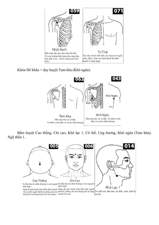 Khóa Hổ khẩu + day huyệt Tam kha (Khô ngân).
Bấm huyệt Cao thống, Chí cao, Khô lạc 1, Cô thế, Ung hương, Khô ngân (Tam kha),
Ngũ thốn 1.
 