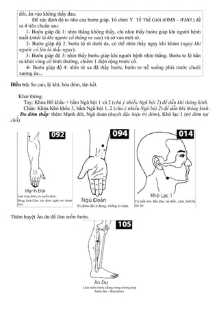 đổi, ấn vào không thấy đau.
Để xác định độ to nhỏ của bướu giáp, Tổ chức Y Tế Thế Giới (OMS - WHO ) đề
ra 4 tiêu chuẩn sau:
1- Bướu giáp độ 1: nhìn thẳng không thấy, chỉ nhìn thấy bướu giáp khi người bệnh
nuốt (nhất là khi ngước cổ thẳng ra sau) và sờ vào mới rõ.
2- Bướu giáp độ 2: bướu lộ rõ dưới da, có thể nhìn thấy ngay khi khám (ngay khi
ngước cổ lên là thấy ngay).
3- Bướu giáp độ 3: nhìn thấy bướu giáp khi người bệnh nhìn thẳng. Bướu to lộ hẳn
ra khỏi vòng cổ bình thường, chiếm 1 diện rộng trước cổ.
4- Bướu giáp độ 4: nhìn từ xa đã thấy bướu, bướu to trễ xuống phía trước chuôi
xương ức...
Điều trị: Sơ can, lý khí, hóa đờm, tán kết.
Khai thông.
Tay: Khóa Hổ khẩu + bấm Ngũ bội 1 và 2 (chú ý nhiều Ngũ bội 2) để dẫn khí thông kinh.
Chân: Khóa Khô khốc 3, bấm Ngũ bội 1, 2 (chú ý nhiều Ngũ bội 2) để dẫn khí thông kinh.
. Do đờm thấp: thêm Mạnh đới, Ngũ đoán (huyệt đặc hiệu trị đờm), Khô lạc 1 (trị đờm tại
chỗ).
Thêm huyệt Án dư để làm mềm bướu.
 
