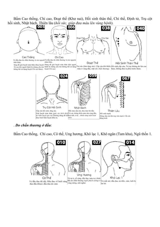 Bấm Cao thống, Chí cao, Đoạt thế (Khư nai), Hồi sinh thân thể, Chí thế, Định tử, Trụ cột
hồi sinh, Nhật bách, Thiên lâu (hồi sức, giúp đưa máu lên vùng bệnh).
. Do chấn thương ở đầu:
Bấm Cao thống, Chí cao, Cô thế, Ung hương, Khô lạc 1, Khô ngân (Tam kha), Ngũ thốn 1.
 