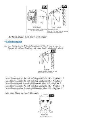 . Do huyết áp cao: Xem mục ‘Huyết áp cao’
9.Chấn thương mặt
Sau chấn thương, thường để lại di chứng là các vết bầm do máu tụ, máu ứ…
Nguyên tắc điều trị là thông kinh, hoạt huyết, hành huyết, tán ứ.
. Máu bầm vùng trán: Ấn tinh phối hợp với Khóa HK + Ngũ bội 1, 2.
. Máu bầm vùng mắt: Ấn tinh phối hợp với Khóa HK + Ngũ bội 4.
. Máu bầm vùng má: Ấn tinh phối hợp với Khóa HK + Ngũ bội 2.
. Máu bầm vùng mũi: Ấn tinh phối hợp với Khóa HK + Ngũ bội 1, 2.
. Máu bầm vùng cằm: Ấn tinh phối hợp với Khóa HK + Ngũ bội 2.
. Mặt sưng: Nhâm tuế (huyệt đặc hiệu).
 