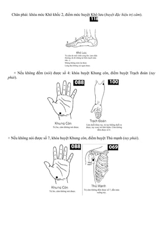 Chân phải: khóa móc Khô khốc 2, điểm móc huyệt Khô lưu (huyệt đặc hiệu trị câm).
+ Nếu không đếm (nói) được số 4: khóa huyệt Khung côn, điểm huyệt Trạch đoán (tay
phải).
+ Nếu không nói được số 7, khóa huyệt Khung côn, điểm huyệt Thủ mạnh (tay phải).
 