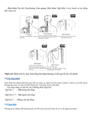 Bấm thêm Trụ cột, Ung hương, Lâm quang, Mộc đoán, Ngũ thốn 1 (các huyệt có tác động
đến vùng cổ).
Nhận xét: Bệnh mới bị, thực hiện đúng thủ pháp thường có kết quả rất tốt, rất nhanh.
14.Cột sống bệnh
Gồm nhiều hội chứng bệnh liên quan đến cột sống, tuy nhiên trên lâm sàng và phạm vi điều trị của bấm huyệt,
thường tập trung vào một số bệnh chứng như: Cụp lưng, thoát vị đĩa đệm…
Cột sống lưng có liên hệ với 4 đường kinh Ngũ bội”
Ngũ bội 1 : Mặt trong cột sống.
Ngũ bội 4, 5 : Mặt ngoài cột sống.
Ngũ bội 2 : Thẳng vào cột sống.
15.Cứng hàm
Thường do di chứng chấn thương hoặc tai biến mạch máu não hoặc do sái cơ do ngáp quá mạnh…
 