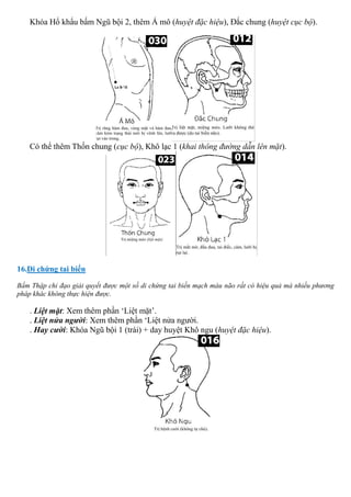 Khóa Hổ khẩu bấm Ngũ bội 2, thêm Á mô (huyệt đặc hiệu), Đắc chung (huyệt cục bộ).
Có thể thêm Thốn chung (cục bộ), Khô lạc 1 (khai thông đường dẫn lên mặt).
16.Di chứng tai biến
Bấm Thập chỉ đạo giải quyết được một số di chứng tai biến mạch máu não rất có hiệu quả mà nhiều phương
pháp khác không thực hiện được.
. Liệt mặt: Xem thêm phần ‘Liệt mặt’.
. Liệt nửa người: Xem thêm phần ‘Liệt nửa người.
. Hay cười: Khóa Ngũ bội 1 (trái) + day huyệt Khô ngu (huyệt đặc hiệu).
 