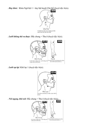 . Hay khóc: Khóa Ngũ bội 1 + day bật huyệt Chú thế (huyệt đặc hiệu).
. Lưỡi không thè ra được: Đắc chung + Thu ô (huyệt đặc hiệu).
. Lưỡi rụt lại: Khô lạc 1 (huyệt đặc hiệu).
. Nói ngọng, khó nói: Đắc chung + Thu ô (huyệt đặc hiệu).
 
